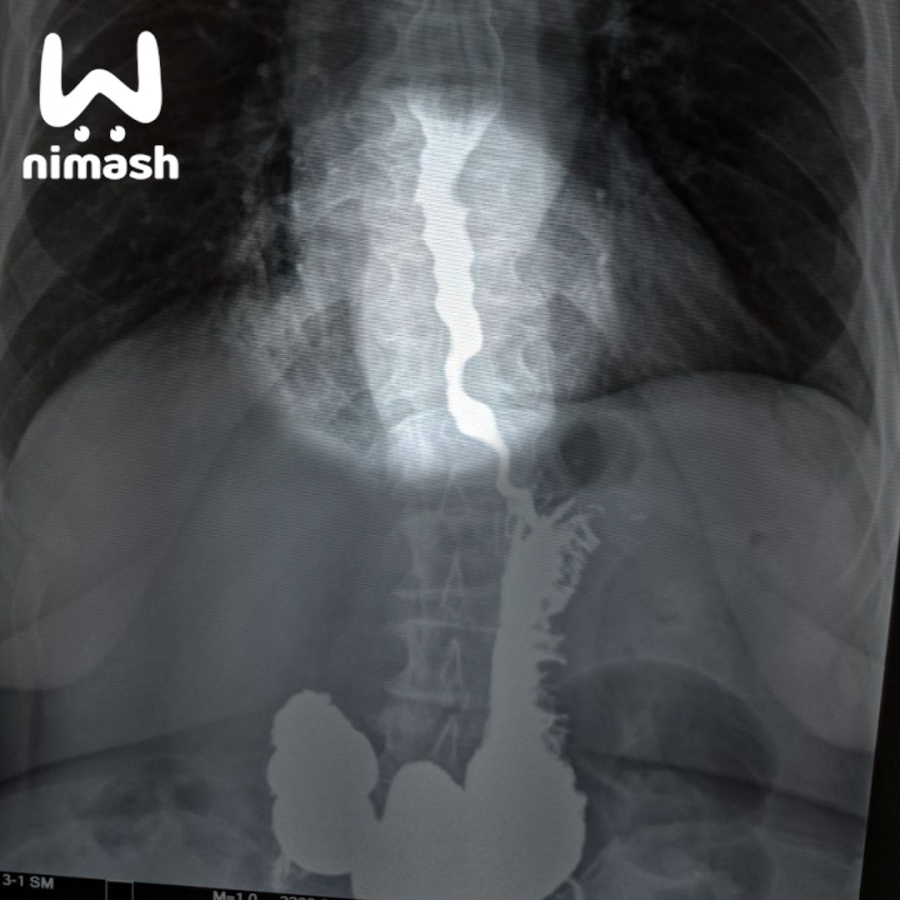 давыдов дмитрий викторович. доктор,ежов,арзамас. салазников андрей. врач хирург арзамас.